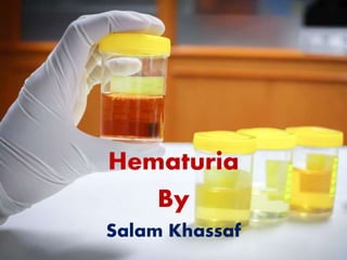 Hematuria
By
Salam Khassaf
 