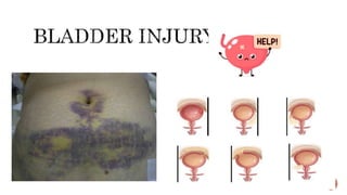 Hematuria for patient education | PPTX