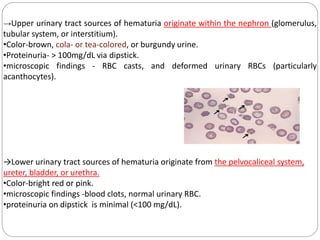 →Upper urinary tract sources of hematuria originate within the nephron (glomerulus,
tubular system, or interstitium).
•Color-brown, cola- or tea-colored, or burgundy urine.
•Proteinuria- > 100mg/dL via dipstick.
•microscopic findings - RBC casts, and deformed urinary RBCs (particularly
acanthocytes).
→Lower urinary tract sources of hematuria originate from the pelvocaliceal system,
ureter, bladder, or urethra.
•Color-bright red or pink.
•microscopic findings -blood clots, normal urinary RBC.
•proteinuria on dipstick is minimal (<100 mg/dL).
 