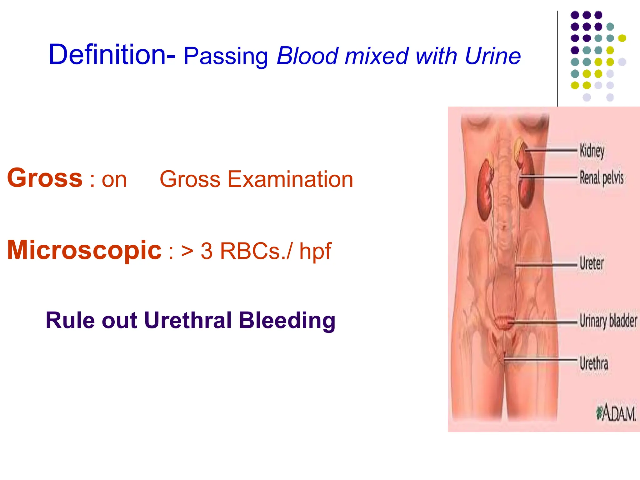 Approach to a patient with hematuria.pptx