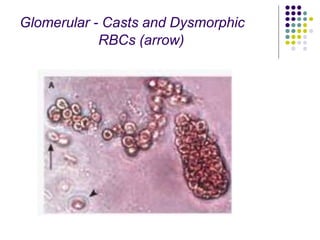 Approach to a patient with hematuria.pptx