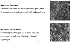 Eumorphic Rbc Hematuria for lecture and education .ppt