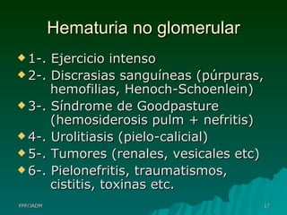 Hematuria no glomerular 1-. Ejercicio intenso 2-. Discrasias sanguíneas (púrpuras,   hemofilias, Henoch-Schoenlein) 3-. Síndrome de Goodpasture     (hemosiderosis pulm + nefritis) 4-. Urolitiasis (pielo-calicial) 5-. Tumores (renales, vesicales etc) 6-. Pielonefritis, traumatismos,     cistitis, toxinas etc. 