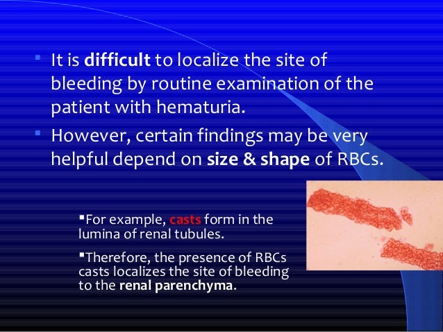 icd 10 code for hematuria