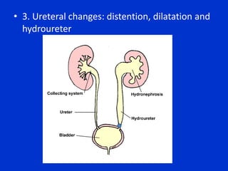 Glomerular HematuriaBegin with a thorough history