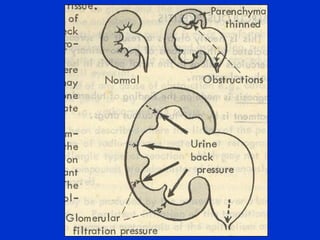 Familial nephritis or Alport's syndrome