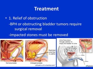 An algorithm for the evaluation of nonglomerular hematuria
