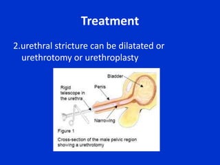 Work –up : Laboratory StudiesUrinalysis