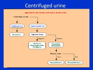 Different shades of blue-green are produced according to the concentration of hemoglobin in the urine 