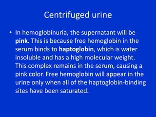 Centrifuged urine
