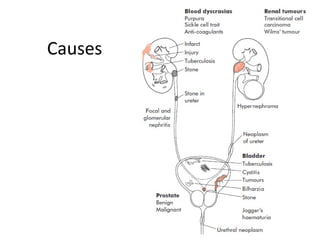 Causes
 