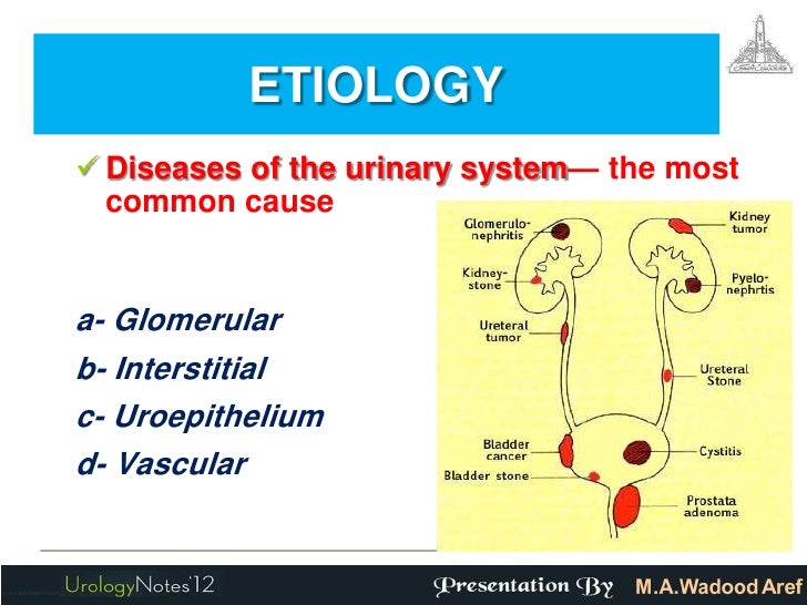 Hematuria for undergraduates
