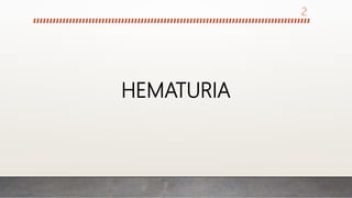 HEMATURIA
2
 
