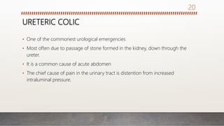 URETERIC COLIC
• One of the commonest urological emergencies
• Most often due to passage of stone formed in the kidney, down through the
ureter.
• It is a common cause of acute abdomen
• The chief cause of pain in the urinary tract is distention from increased
intraluminal pressure.
20
 
