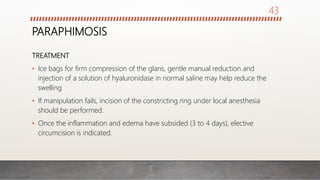 PARAPHIMOSIS
TREATMENT
• Ice bags for firm compression of the glans, gentle manual reduction and
injection of a solution of hyaluronidase in normal saline may help reduce the
swelling
• If manipulation fails, incision of the constricting ring under local anesthesia
should be performed.
• Once the inflammation and edema have subsided (3 to 4 days), elective
circumcision is indicated.
43
 