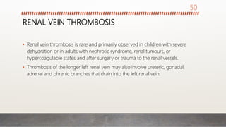 RENAL VEIN THROMBOSIS
• Renal vein thrombosis is rare and primarily observed in children with severe
dehydration or in adults with nephrotic syndrome, renal tumours, or
hypercoagulable states and after surgery or trauma to the renal vessels.
• Thrombosis of the longer left renal vein may also involve ureteric, gonadal,
adrenal and phrenic branches that drain into the left renal vein.
50
 
