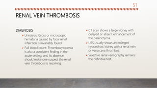 RENAL VEIN THROMBOSIS
DIAGNOSIS
 Urinalysis: Gross or microscopic
hematuria caused by focal renal
infarction is invariably found.
 Full blood count: Thrombocytopenia
is also a consistent finding in the
acute setting, and its absence
should make one suspect the renal
vein thrombosis is resolving.
 CT scan shows a large kidney with
delayed or absent enhancement of
the parenchyma.
 USS usually shows an enlarged
hypoechoic kidney with a renal vein
or vena cava thrombus.
 Selective renal venography remains
the definitive test.
51
 