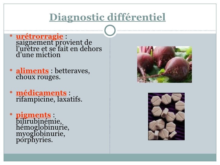 hématurie