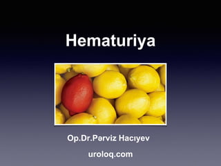 Hematuriya
Op.Dr.Pərviz Hacıyev
uroloq.com
 