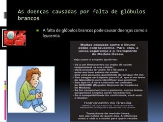 As doenças causadas por falta de glóbulos brancosA falta de glóbulos brancos pode causar doenças como a leucemia 