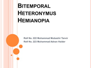 BITEMPORAL
HETERONYMUS
HEMIANOPIA
Roll No. 222 Muhammad Mubashir Tanvir
Roll No. 223 Muhammad Adnan Haider
 