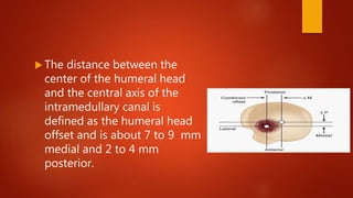  The distance between the
center of the humeral head
and the central axis of the
intramedullary canal is
defined as the humeral head
offset and is about 7 to 9 mm
medial and 2 to 4 mm
posterior.
 