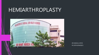 HEMIARTHROPLASTY
DR ANSHUL SETHI
PG ORTHOPAEDICS
 
