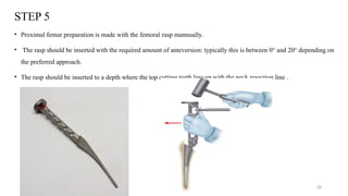 The Hemiarthroplasty of Hip Principles.pptx