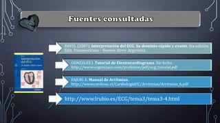 DAVIS. (2007). Interpretación del ECG. Su dominio rápido y exacto. 4ta edición.
Edit. Panamericana – Buenos Aires: Argentina.
GONZALEZ J. Tutorial de Electrocardiograma. Sin fecha.
http://www.urgenciauc.com/profesion/pdf/ecg_tutorial.pdf
FAJURI A. Manual de Arritmias.
http://www.cardiouc.cl/CardiologiaUC/Arritmias/Arritmias_6.pdf
http://www.lrubio.es/ECG/tema3/tema3-4.html
 