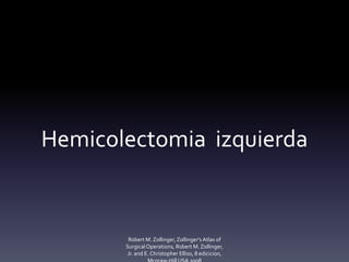 Hemicolectomia izquierda
Robert M. Zollinger,Zollinger'sAtlas of
SurgicalOperations, Robert M. Zollinger,
Jr. and E. Christopher Elliso, 8 edicicion,
 