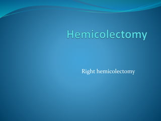 Right hemicolectomy
 