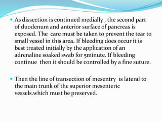  As dissection is continued medially , the second part
of duodenum and anterior surface of pancreas is
exposed. The care must be taken to prevent the tear to
small vessel in this area. If bleeding does occur it is
best treated initially by the application of an
adrenaline soaked swab for 5minute. If bleeding
continue then it should be controlled by a fine suture.
 Then the line of transection of mesentry is lateral to
the main trunk of the superior mesenteric
vessels.which must be preserved.
 