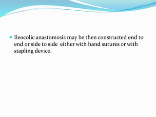  Ileocolic anastomosis may be then constructed end to
end or side to side either with hand sutures or with
stapling device.
 