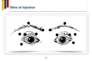 Sites of injection
55
 