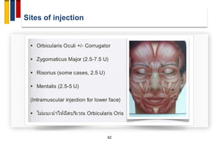 Sites of injection
62
 