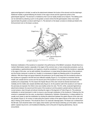 splenorenal ligament is divided, as well as the attachments between the fundus of the stomach and the diaphragm.
Additional mobility is gained following the division of the vagus nerves and the uppermost portion of the
gastrohepatic ligament. The stomach is mobilized so that it can be readily divided at its midpoint. The halfway point
can be estimated by selecting a point on the greater curvature where the left gastroepiploic artery most nearly
approximates the greater curvature wall (Figure 1). The stomach on the lesser curvature is divided just distal to the
third prominent vein on the lesser curvature.




Extensive mobilization of the duodenum is essential in the performance of the Billroth I procedure. Should there be a
marked inflammatory reaction, especially in the region of the common duct, a more conservative procedure, such as
a pyloroplasty or gastroenterostomy and vagotomy, should be considered. If it appears that the duodenum, especially
in the region of the ulcer, can be well mobilized, the peritoneum is incised along the lateral border of the duodenum
and the Kocher maneuver is carried out. Usually it is unnecessary to ligate any bleeding points in this peritoneal
reflection. With blunt finger and gauze dissection the peritoneum can be swept away from the duodenal surface as
the duodenum is grasped in the left hand and reflected medially (Figure 2). It is important to remember that the
middle colic vessels tend to course over the second part of the duodenum and are many times encountered rather
suddenly and unexpectedly. For this reason the hepatic flexure of the colon should be directed downward and
medially and the middle colic vessels identified early (Figure 2). As the posterior wall of the duodenum and head of
the pancreas are exposed, the inferior vena cava readily comes into view. The firm, white, avascular ligamentous
attachments between the second and third parts of the duodenum and the posterior parietal wall are divided with
curved scissors, down through and almost including the region of the ligament of Treitz (Figure 2). This extensive
mobilization is carried downward in order to ensure a very thorough mobilization of the duodenum. Following this, the
omentum is separated from the colon, as described in Gastrectomy, Subtotal—Omentectomy. In obese patients it is
usually much easier to start the mobilization by dividing the attachment between the splenic flexure of the colon and
the parietes (Figure 3). An incision is made along the superior surface of the splenic flexure of the colon as the next
step in freeing up the omentum. This should be done in an avascular cleavage plane. The lesser sac is entered from
the left side. Care should be taken not to apply undue traction upon the tissues extending up to the spleen, since the
splenic capsule may be torn, and troublesome bleeding, even to the point of requiring splenectomy, may be
encountered.
 