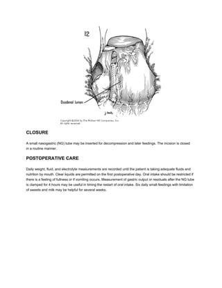 CLOSURE

A small nasogastric (NG) tube may be inserted for decompression and later feedings. The incision is closed
in a routine manner.

POSTOPERATIVE CARE

Daily weight, fluid, and electrolyte measurements are recorded until the patient is taking adequate fluids and
nutrition by mouth. Clear liquids are permitted on the first postoperative day. Oral intake should be restricted if
there is a feeling of fullness or if vomiting occurs. Measurement of gastric output or residuals after the NG tube
is clamped for 4 hours may be useful in timing the restart of oral intake. Six daily small feedings with limitation
of sweets and milk may be helpful for several weeks.
 
