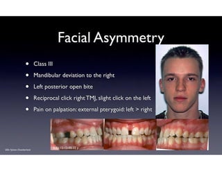 Asymétrie des masséters - Dr Sylvain Chamberland, Orthodontiste