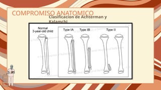 Preentacion de Hemimelia y polidactilia. | PPTX