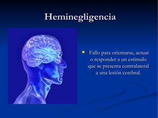 Heminegligencia ,[object Object]