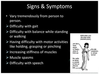 Signs & Symptoms 
• Vary tremendously from person to 
person. 
 Difficulty with gait 
 Difficulty with balance while standing 
or walking 
 Having difficulty with motor activities 
like holding, grasping or pinching 
 Increasing stiffness of muscles 
 Muscle spasms 
 Difficulty with speech 
 