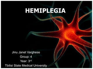 HEMIPLEGIA 
Jinu Janet Varghese 
Group: 4 
Year: 3rd 
Tbilisi State Medical University 
 