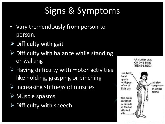 Hemiplegia (1) Hemiplegia (1)