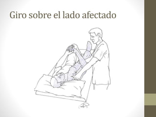 Giro sobre el lado afectado
 