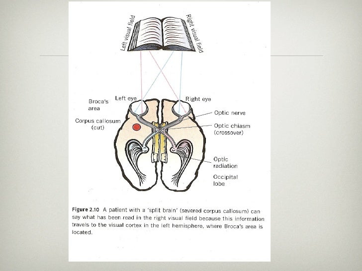 Hemispheric Specialisation Biology Diagrams