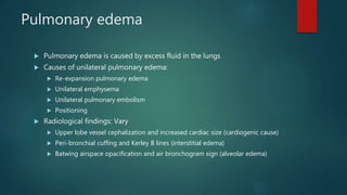 Pulmonary edema
 Pulmonary edema is caused by excess fluid in the lungs
 Causes of unilateral pulmonary edema:
 Re-expansion pulmonary edema
 Unilateral emphysema
 Unilateral pulmonary embolism
 Positioning
 Radiological findings: Vary
 Upper lobe vessel cephalization and increased cardiac size (cardiogenic cause)
 Peri-bronchial cuffing and Kerley B lines (interstitial edema)
 Batwing airspace opacification and air bronchogram sign (alveolar edema)
 