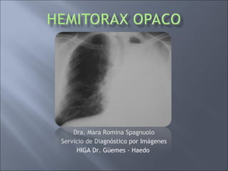 Dra. Mara Romina Spagnuolo Servicio de Diagnóstico por Imágenes HIGA Dr. Güemes - Haedo  