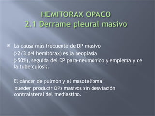 <ul><li>La causa más frecuente de DP masivo </li></ul><ul><li>(>2/3 del hemitórax) es la neoplasia </li></ul><ul><li>(>50%...