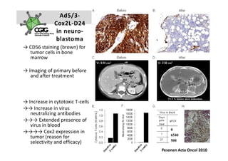 Ad5/3‐
              Cox2L‐D24 
               in neuro‐
               blastoma
→ CD56 staining (brown) for 
  tumor cells in bone 
  marrow

→ Imaging of primary before 
   and after treatment



→ Increase in cytotoxic T‐cells
→→ Increase in virus 
   neutralizing antibodies
→→→ Extended presence of 
   virus in blood
                                                   0
→→→→ Cox2 expression in 
                                                   6540
   tumor (reason for 
           (       f
                                                   500
   selectivity and efficacy)
                                  Pesonen Submitted 2008|    1 7
                                  A k s e l i   H e m m i n k i       |     2 3  F e b  2 0 1 0   
                                        Pesonen Acta Oncol 2010
 