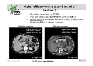 Higher efficacy with a second round of 
                                       treatment
                           •   Metastatic pancreatic ca. WHO 2
                           •   Prior gemcitabine and gemcitabine chemoradiation
                           •   Second round of treatment with Ad5‐24‐RGD (Bauerschmitz 
                               Cancer Res 2002) produced response




                                                                  A k s e l i   H e m m i n k i       |     2 3  F e b  2 0 1 0    |    1 8
Pesonen in preparation
 